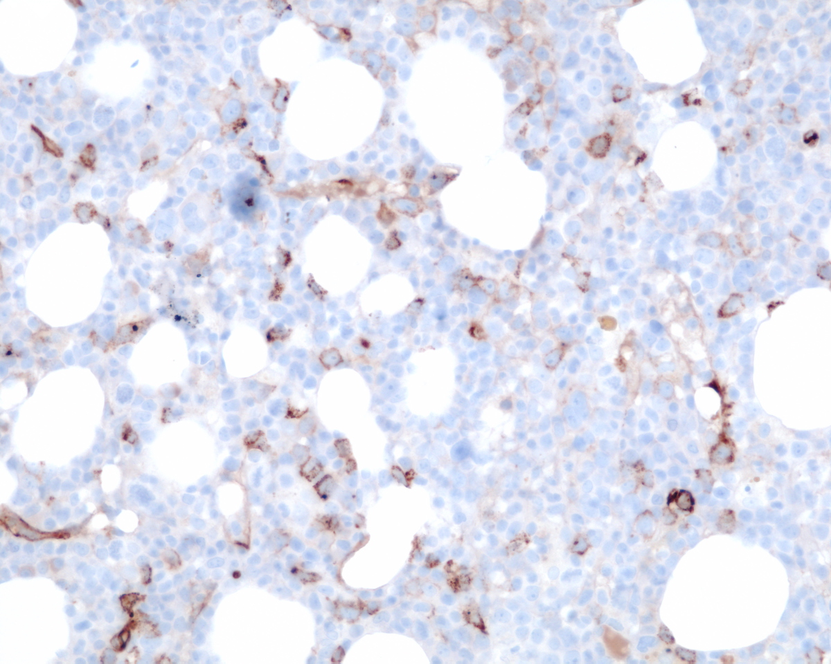 Immunohistochemistry CD34